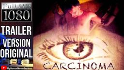 Carcinoma (2014) (Trailer HD) - Marian Dora