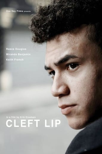Cleft Lip Poster